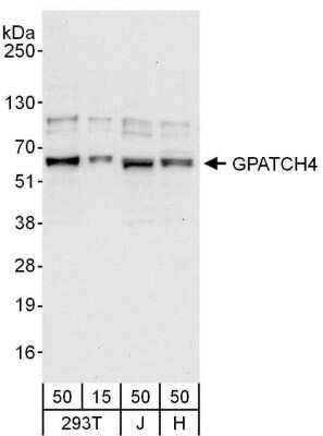 Western Blot: GPATCH4 Antibody [NBP1-79018]