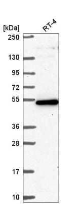 Western Blot: GPATCH4 Antibody [NBP2-55313]