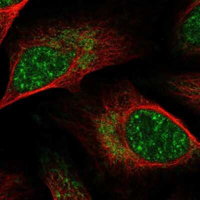 Immunocytochemistry/ Immunofluorescence: GPATCH8 Antibody [NBP1-91959]