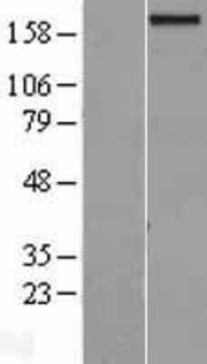 Western Blot: GPATCH8 Overexpression Lysate [NBL1-11216]