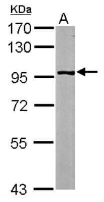 Western Blot: Glycogen Phosphorylase BB/GPBB Antibody [NBP2-20017]