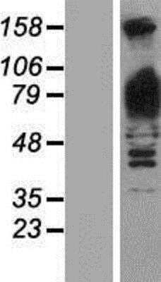 Western Blot: Glycogen Phosphorylase BB/GPBB Overexpression Lysate [NBP2-08065]