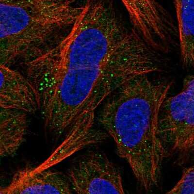 Immunocytochemistry/ Immunofluorescence: GPBP Antibody [NBP1-87980]