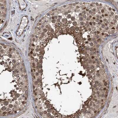 Immunohistochemistry-Paraffin: GPBP Antibody [NBP1-87980]