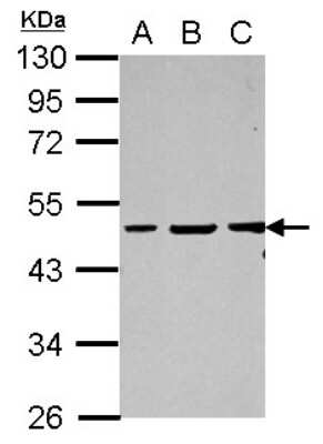 Western Blot: GPBP Antibody [NBP2-16710]