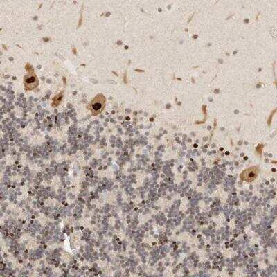Immunohistochemistry-Paraffin: GPBP1L1 Antibody [NBP1-80733]