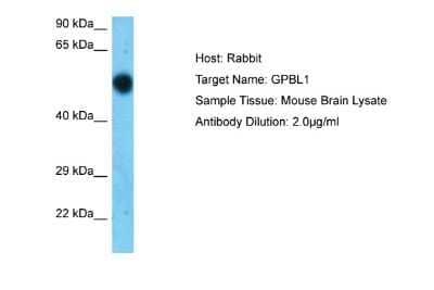 Western Blot: GPBP1L1 Antibody [NBP2-82913]