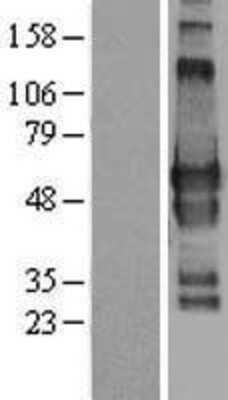 Western Blot: GPBP1L1 Overexpression Lysate [NBL1-11218]