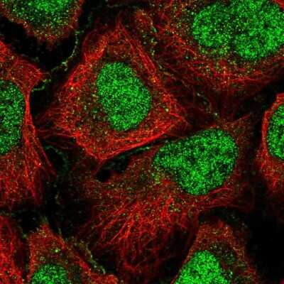 Immunocytochemistry/ Immunofluorescence: GPCPD1 Antibody [NBP2-55271]