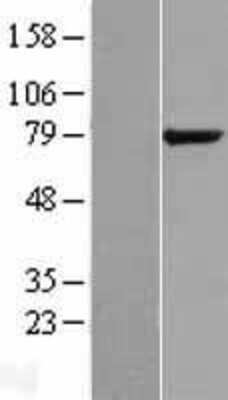 Western Blot: GPCPD1 Overexpression Lysate [NBL1-15487]