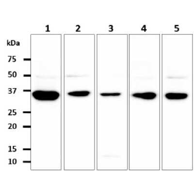 Western Blot: GPD1L Antibody (14E2)BSA Free [NBP2-59439]