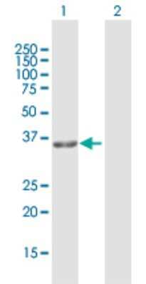 Western Blot: GPD1L Antibody [H00023171-D01P]