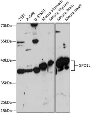 Western Blot: GPD1L AntibodyAzide and BSA Free [NBP3-04696]