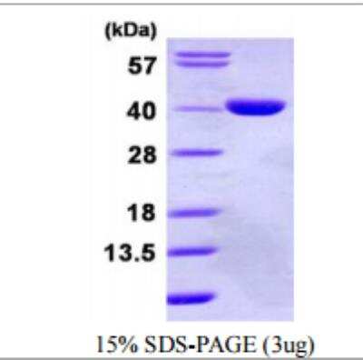 SDS-PAGE: Recombinant Human GPD1L His Protein [NBP1-72456]