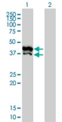 Western Blot: GPD2 Antibody (2C11-1F4) [H00002820-M02]