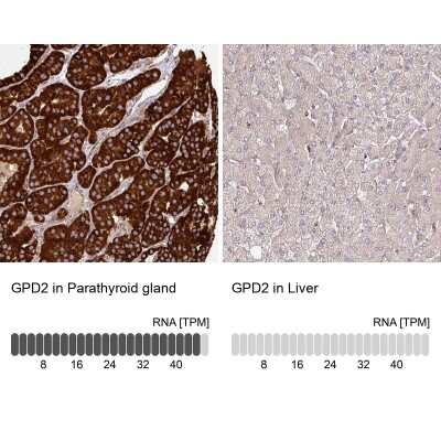 Immunohistochemistry-Paraffin: GPD2 Antibody [NBP2-38542]