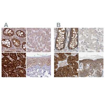 Immunohistochemistry-Paraffin: GPD2 Antibody [NBP2-38542]
