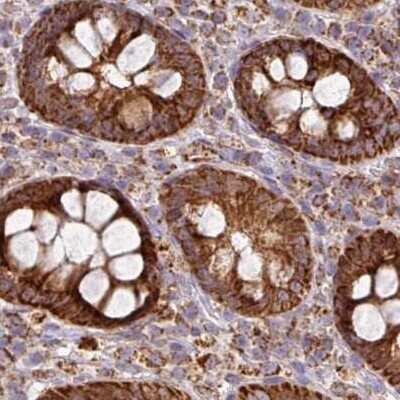 Immunohistochemistry-Paraffin: GPD2 Antibody [NBP2-38542]