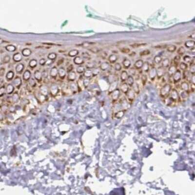 Immunohistochemistry-Paraffin: GPD2 Antibody [NBP2-38542]