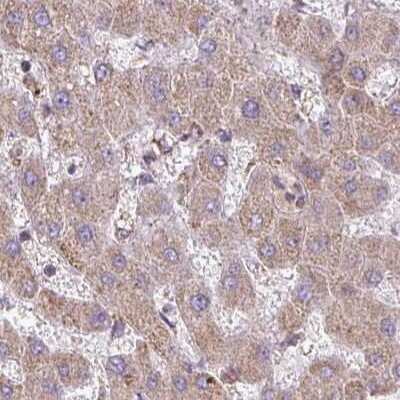 Immunohistochemistry-Paraffin: GPD2 Antibody [NBP2-38542]
