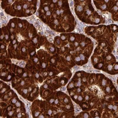 Immunohistochemistry-Paraffin: GPD2 Antibody [NBP2-38542]