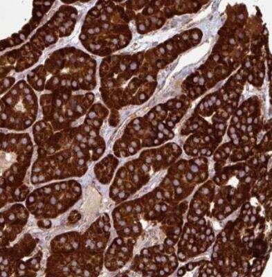 Immunohistochemistry-Paraffin: GPD2 Antibody [NBP2-38542]