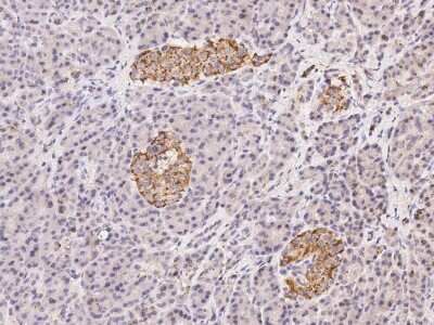 Immunohistochemistry-Paraffin: GPD2 Antibody [NBP2-99207]