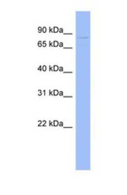 Western Blot: GPD2 Antibody [NBP1-69419]