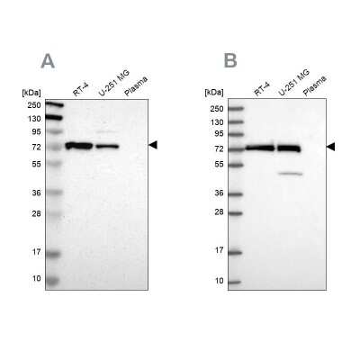 Western Blot: GPD2 Antibody [NBP1-86121]