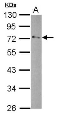 Western Blot: GPD2 Antibody [NBP2-16711]