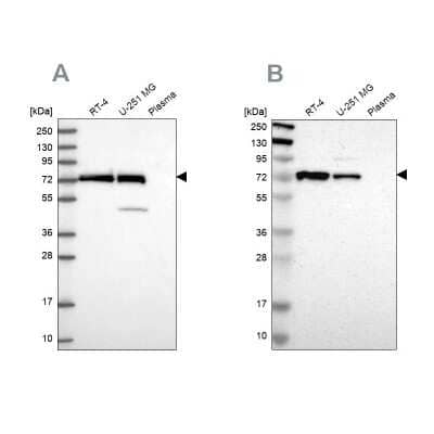 Western Blot: GPD2 Antibody [NBP2-38542]