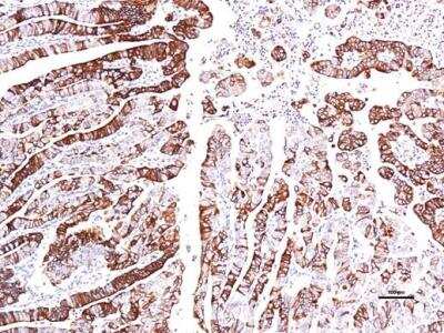 Immunohistochemistry-Paraffin: GPER/GPR30 Antibody [NBP1-31258]