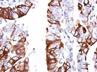 Immunohistochemistry-Paraffin: GPER/GPR30 Antibody [NBP1-31258]