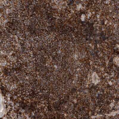 Immunohistochemistry-Paraffin: GPER/GPR30 Antibody [NBP1-88096]