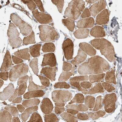Immunohistochemistry-Paraffin: GPER/GPR30 Antibody [NBP1-88096]