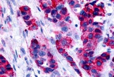 Immunohistochemistry-Paraffin: GPER/GPR30 Antibody - BSA Free [NLS1183]