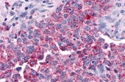 Immunohistochemistry-Paraffin: GPER/GPR30 Antibody - BSA Free [NLS1184]