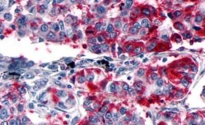Immunohistochemistry-Paraffin: GPER/GPR30 Antibody - BSA Free [NLS1184]