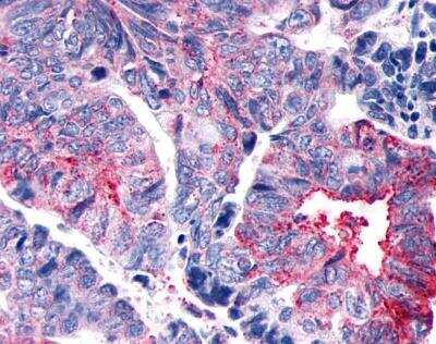 Immunohistochemistry-Paraffin: GPER/GPR30 Antibody - BSA Free [NLS1184]