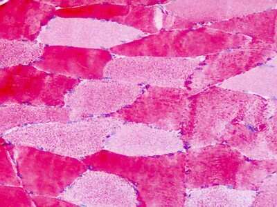 Immunohistochemistry-Paraffin: GPER/GPR30 Antibody - BSA Free [NLS4268]