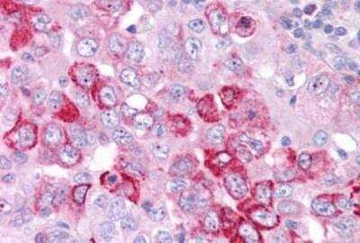 Immunohistochemistry-Paraffin: GPER/GPR30 Antibody - BSA Free [NLS4272]