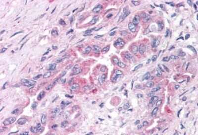 Immunohistochemistry-Paraffin: GPER/GPR30 Antibody - BSA Free [NLS4290]