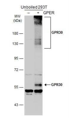 Western Blot: GPER/GPR30 Antibody [NBP1-31258]