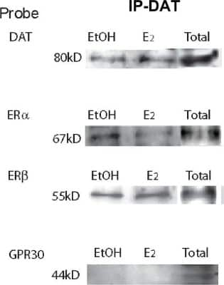 Western Blot: GPER/GPR30 AntibodyBSA Free [NLS4271]