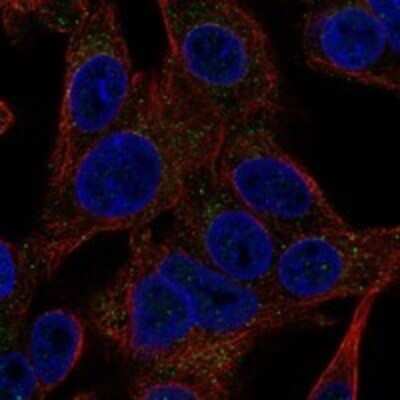 Immunocytochemistry/ Immunofluorescence: GPHA2 Antibody [NBP3-17255]