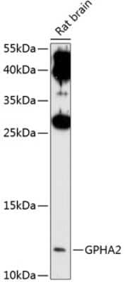 Western Blot: GPHA2 AntibodyAzide and BSA Free [NBP3-04883]