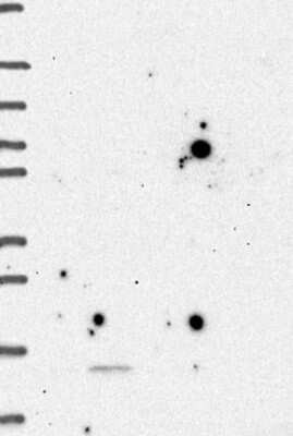 Western Blot: GPHA2 Antibody [NBP3-17255]