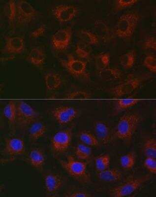 Immunocytochemistry/ Immunofluorescence: GPI-PLD/GPLD1 Antibody - Azide and BSA Free [NBP3-03599]