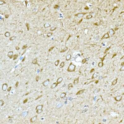 Immunohistochemistry-Paraffin: GPI-PLD/GPLD1 Antibody - Azide and BSA Free [NBP3-03599]