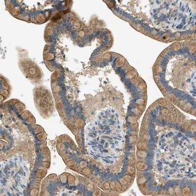 Immunohistochemistry: GPI7 Antibody [NBP1-89853]